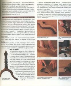 Renowacja - Metody konserwacji antyków i starych przedmiotów